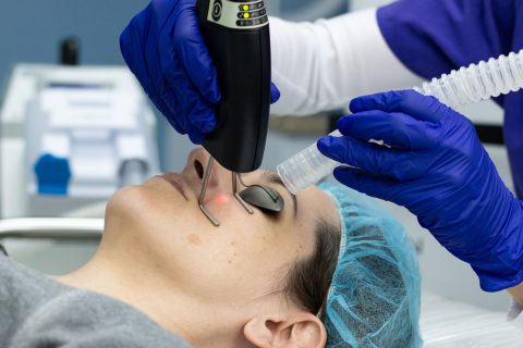 laser surgery on skin