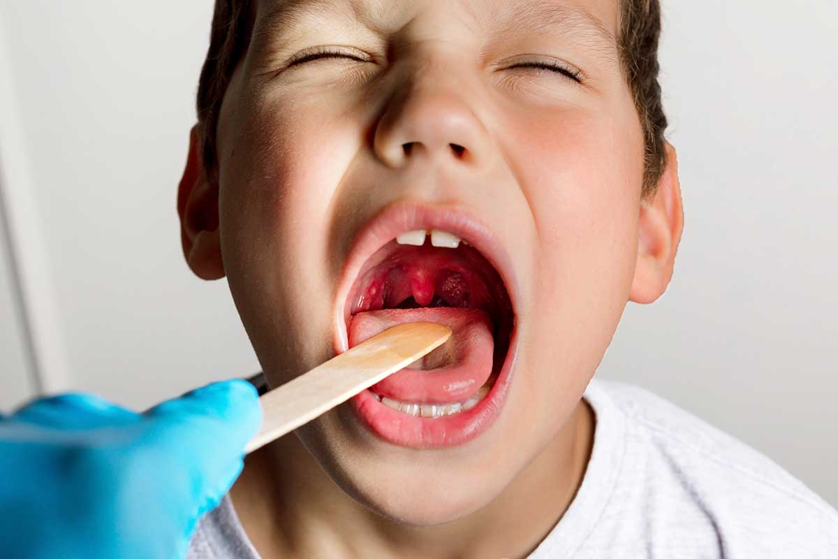 child opening throat. doctor inserts tongue depressor. check for illness, strep throat