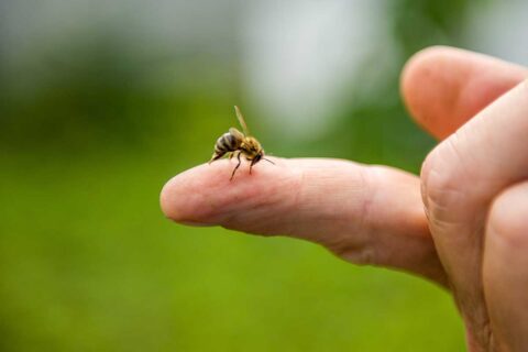 bee sting