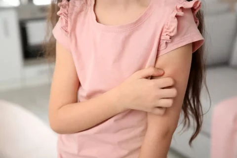 Child scratches arm