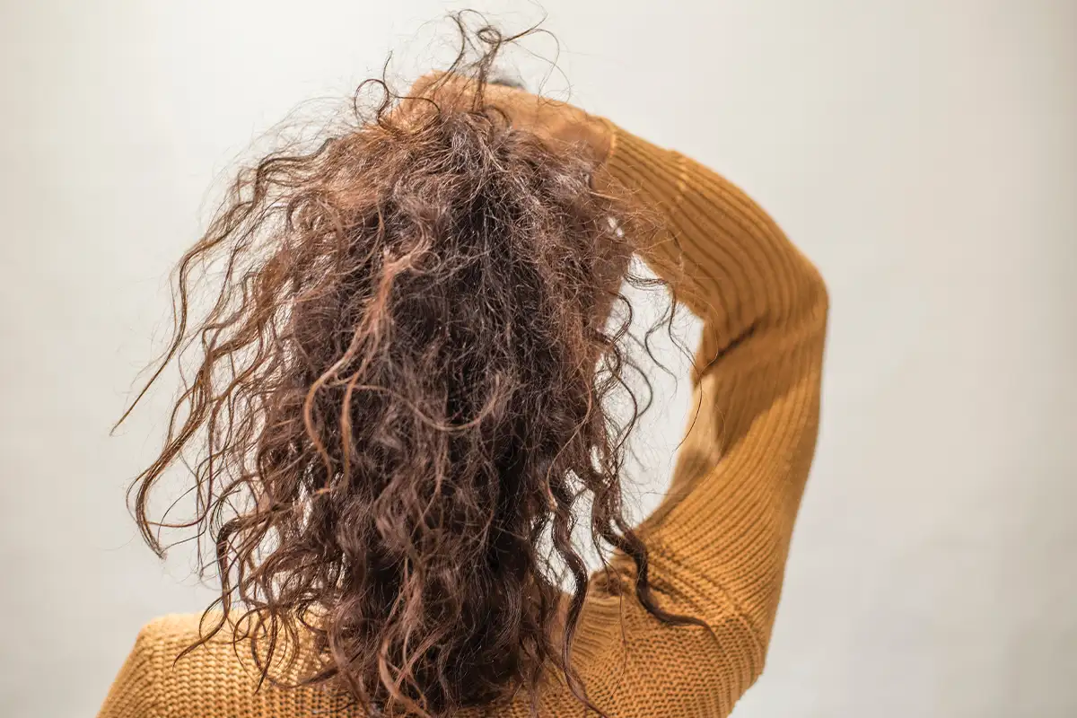 Damaged hair