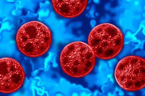 cyclosporiasis